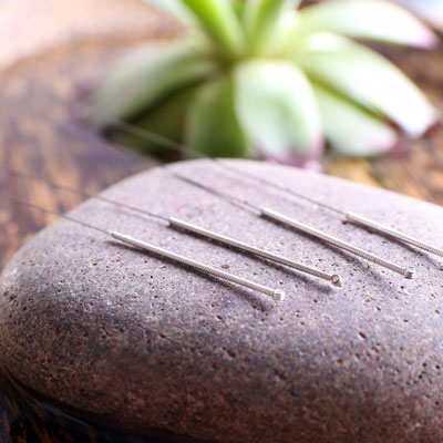 Acupuncture-Needles